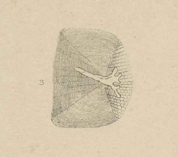 1969.2764 Print, detail 3